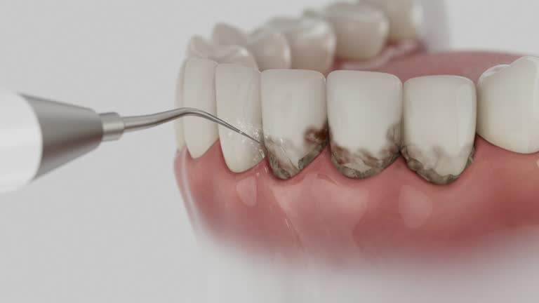 Reliable Dental Implants contractor in Gonzales, CA by Smile Center Dentistry